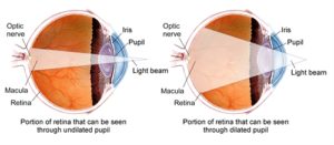 Retina Pupil Comparison | Eye Exam Diagram